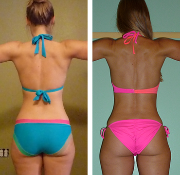 brazilian butt lift workout before-and-after